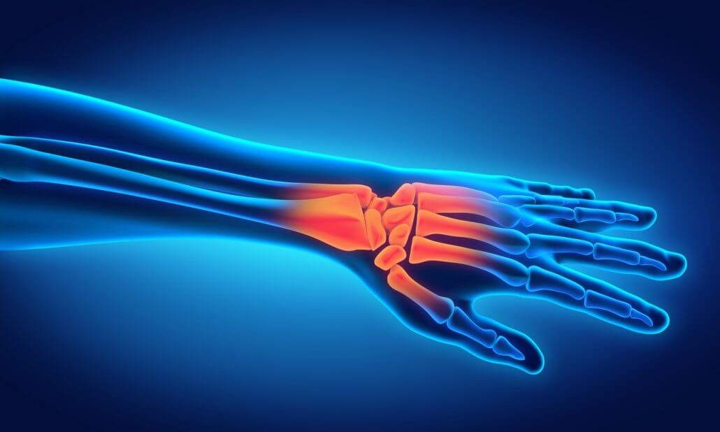 Anatomischer Aufbau der Hand Minimalinvasive Handchirurgie in Berlin