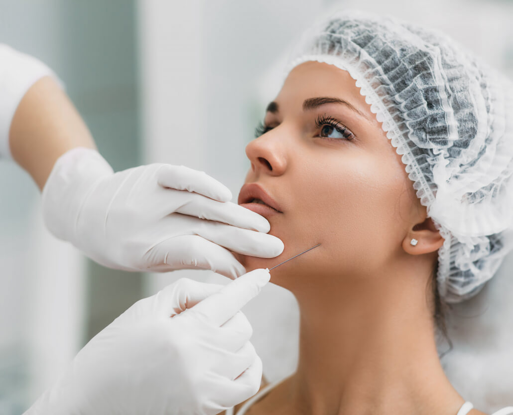 Aesthetic face surgery,cosmetic technique, mesothreads lifting and contouring face